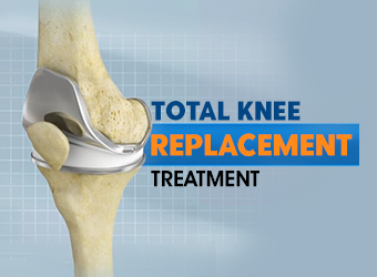 Total Knee Replacement Surgery Procedure, Treatment, Exercises.