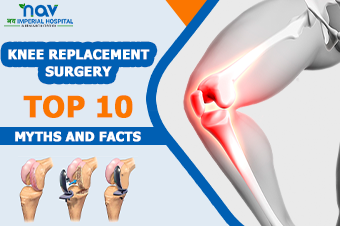 Knee Replacement Surgery- Top 10 Myths and Facts
