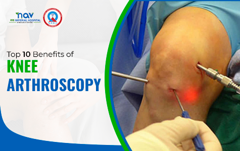 Top 10 Benefits of Knee Arthroscopy