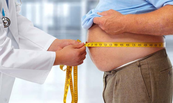 Low-cost and best bariatric surgery overview at Nav Imperial Hospital, Jaipur's renowned healthcare center.