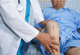 Knee Replacement Surgery Image