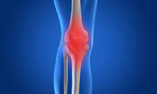 Knee-replacement-surgery