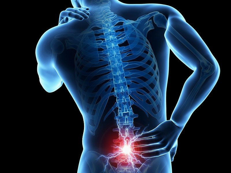 Lower-back-pain