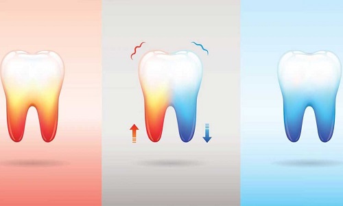 Treatment-for-Teeth-Sensitivity